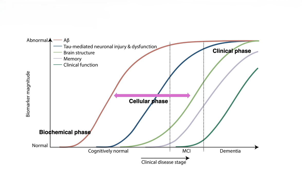 Line graph showing amyloid-beta changes first, followed by tau-related neuronal injury, brain atrophy, memory decline, and loss of clinical function as Alzheimer’s disease progresses.