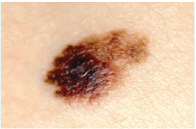 Border irregularity image