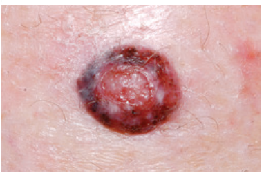 Colour variation image