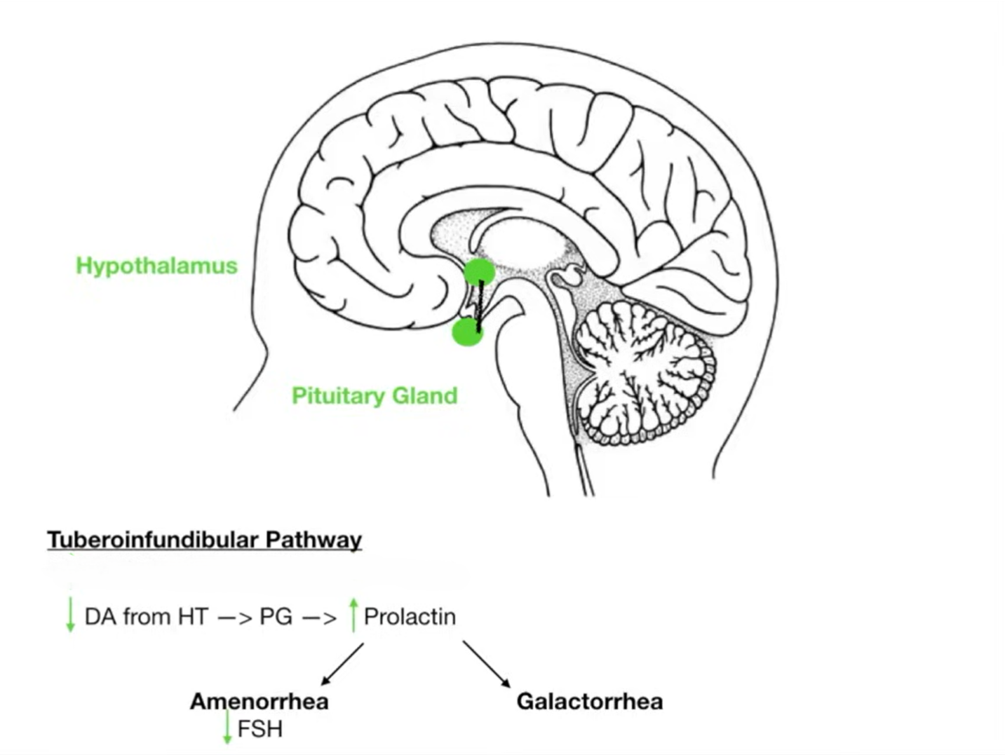Tuberoinfundibular Pathway; Mechanism of hyperprolactinaemia